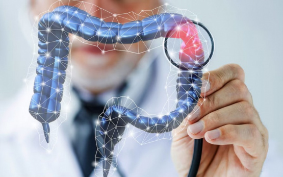 Cáncer de colon: Argentina lidera las tasas de incidencia en la región 