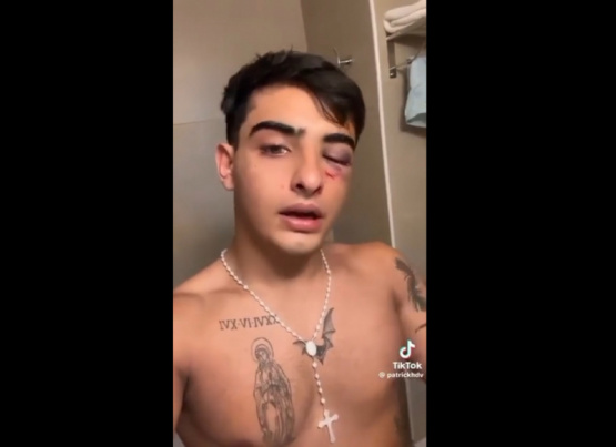 20 rugbiers golpearon a un joven de 19 años